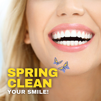 The image is a promotional advertisement featuring a smiling woman with a yellow and blue butterfly graphic on her face. Below the woman, there's text that reads 'SPRING CLEAN YOUR SMILE!
